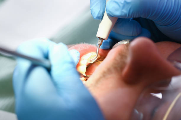 Best Emergency TMJ Treatment in Sherrill, NY
