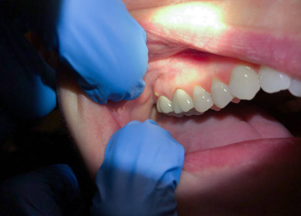 Best Urgent Care for Lost Fillings or Crowns in Sherrill, NY
